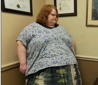 Nuk do t’iu besoni syve: Gruaja që humbi 180 kile për 4 vite, si duket ajo tani (FOTO)