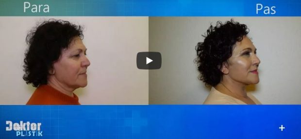 Surpriza e 64-vjeçares për 3 fëmijët e saj: Freskinë e shpirtit doja ta pasqyroja dhe… (VIDEO)