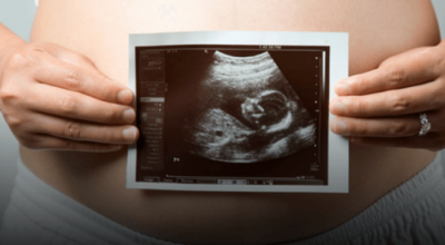 Lexoni disa këshilla për të patur një shtatzëni sa më të mbarë