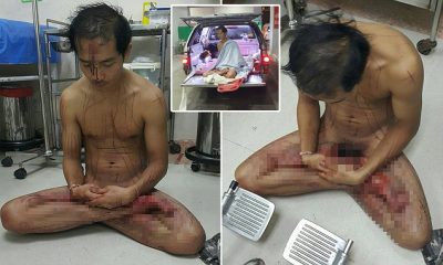 Shikon video porno, 30-vjeçari pret me thikë organet e tij gjenitale (FOTO)