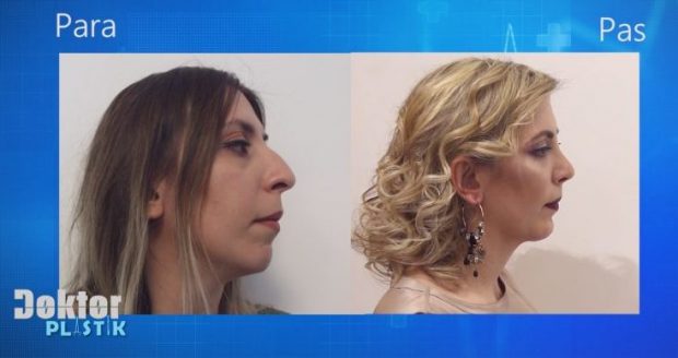 Mësuesja shqiptare realizon ëndrrën e saj! Shikoni ndryshimin drastik pas operacionit (VIDEO)