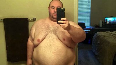 U shëndosh aq sa nuk bënte dot seks/ Burri bie plot 100 kg dhe ja si duket tani (FOTO)
