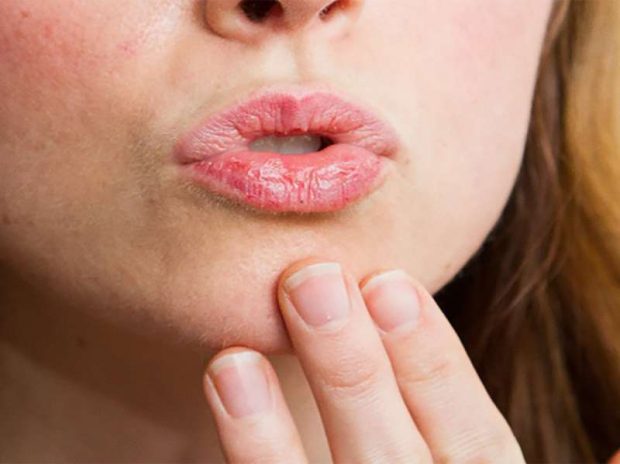 Si ti kuroni buzët e plasaritura brenda ditës