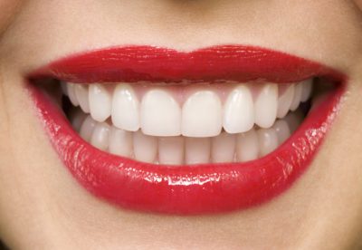 Dhëmbë të bardhë dhe të fortë? Këto janë 9 ushqimet që duhet të konsumojmë