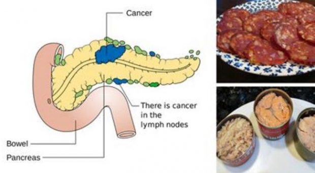 MOS I KONSUMONI MË/ Këto janë ushqimet që shkaktojnë kancer