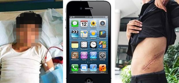 HISTORIA QË TRONDITI VENDIN/ Shiti veshkën për të blerë iPhone, 25-vjeçari mbetet “gjysmë njeri”