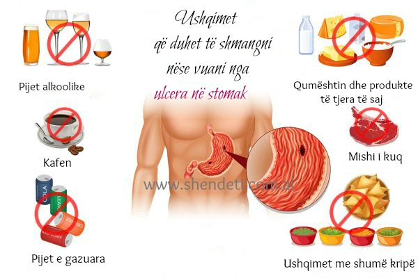 NGA MISHI TEK QUMËSHTI/ Ushqimet që duhet të shmangni nëse vuani nga ulcera në stomak