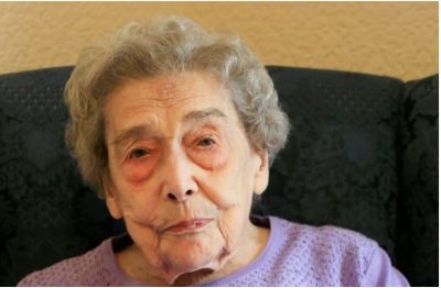 BEQARIA/ Gruaja 106 vjeçare rrëfen sekretin e jetëgjatësisë