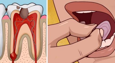 BRENDA 5 MINUTAVE/ 7 metoda efikase si ta qetësoni dhimbjen e dhëmbit
