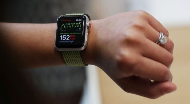 KINI KUJDES/ Dermatologët: “Apple Watch”, të rrezikshëm për shëndetin