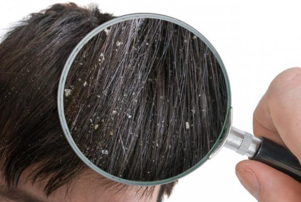 SHMANGINI SA MË SHUMË TË MUNDENI/ 4 faktorë të jashtëm që krijojnë zbokthin në flokët tuaj