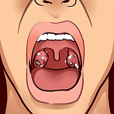 KUJDES! Këto janë 8 gjerat që shija e keqe e gojës po përpiqet t’ju tregojë
