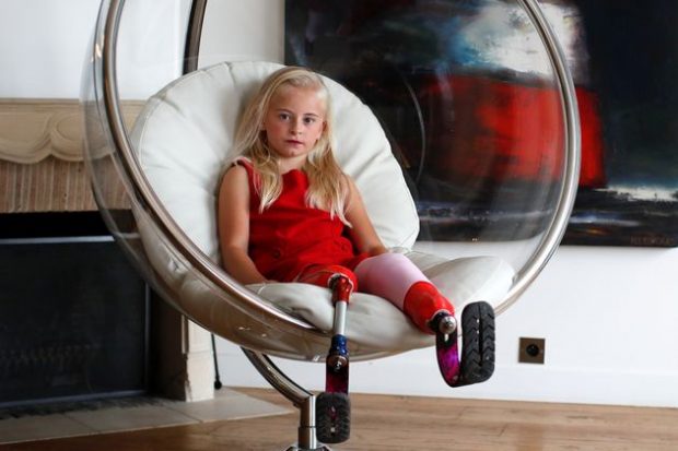 E MREKULLUESHME/ Historia e vajzës me këmbë të prera që shkëlqeu në pasarelën në Paris