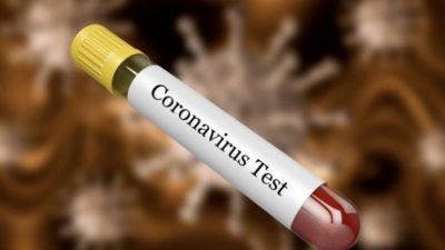 KORONAVIRUSI/ Si kryhet dhe sa kushton testi për Covid-19