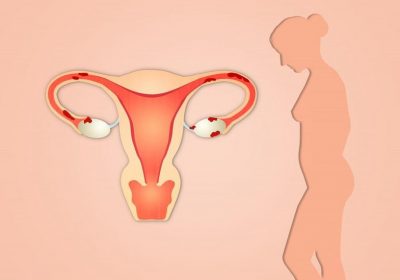 SHENJË E KANCERIT/ Çfarë s’duhet të injorojnë gratë pas menopauzës