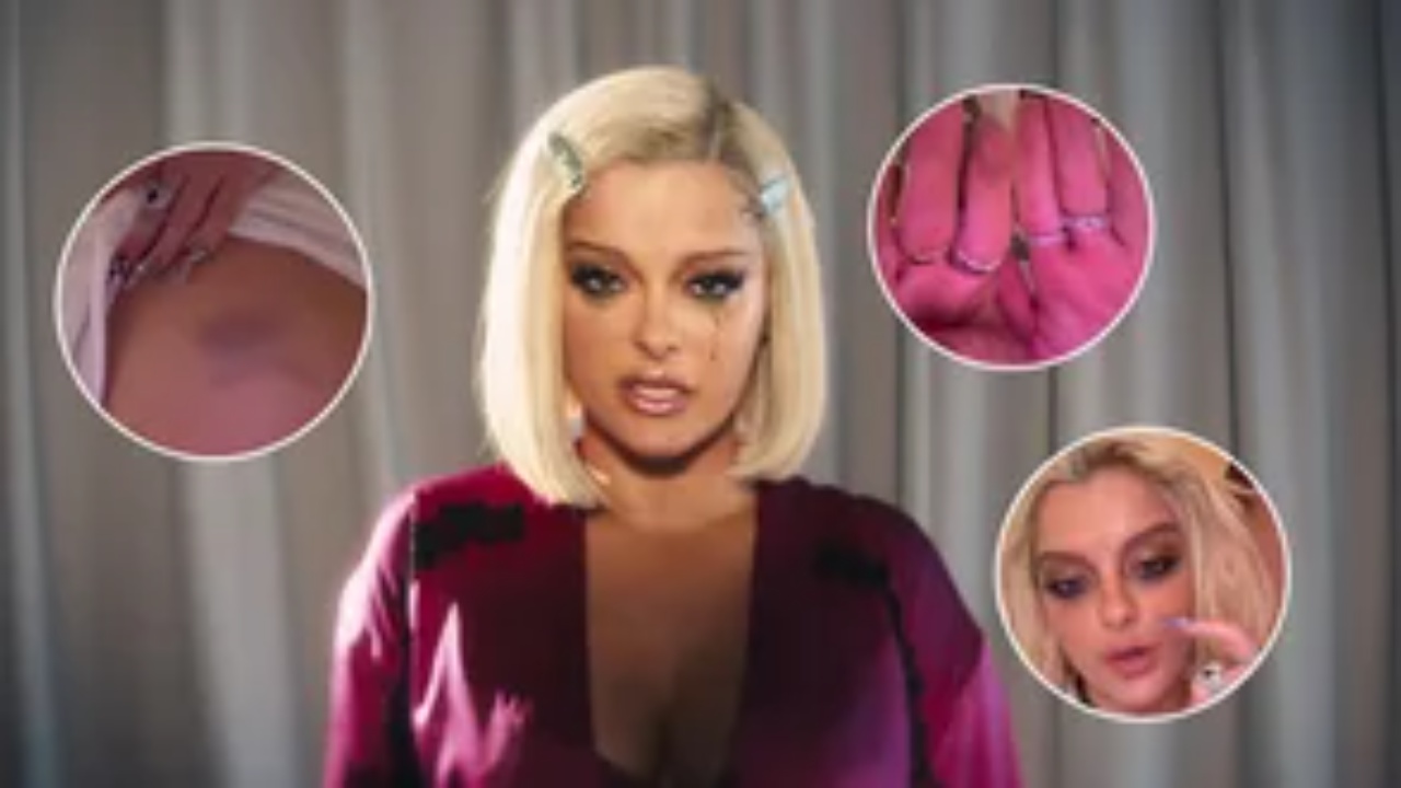 REALIZOI 13 KLIPE BRENDA TRI DITËSH/ Bebe Rexha tregon pasojat në trupin dhe shëndetin e saj